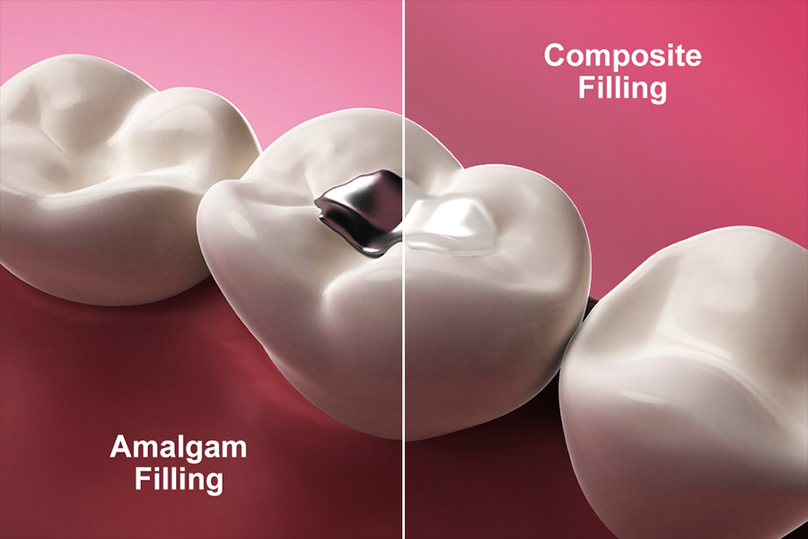 filling